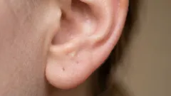 Warum sich so viel Ohrenschmalz in den Ohren ansammelt: Die Wahrheit, über die niemand spricht
